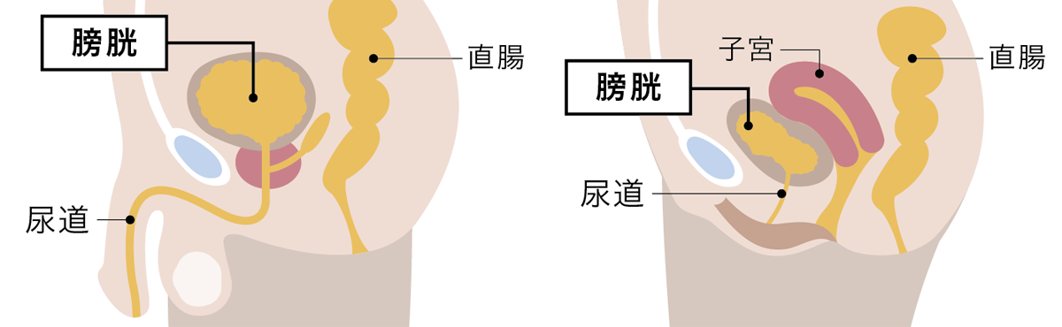 膀胱炎イメージ