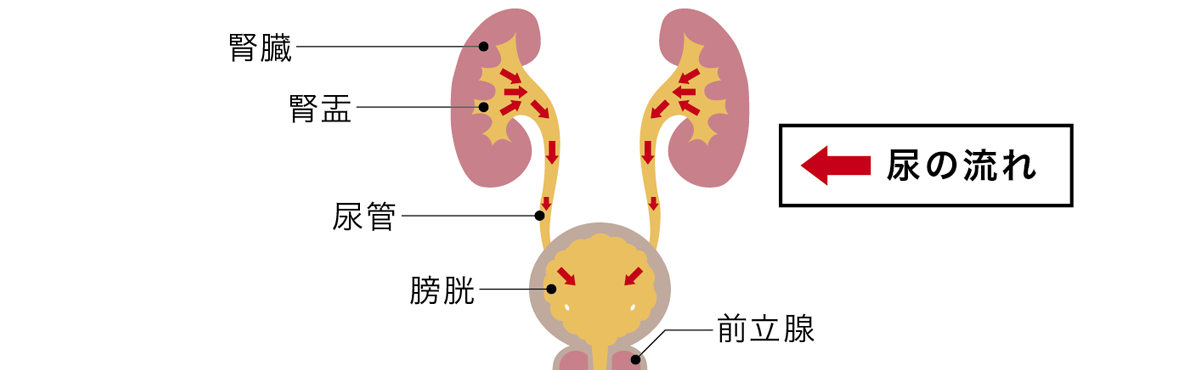 腎盂腎炎イメージ