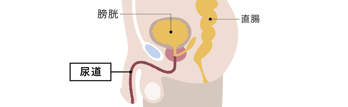 尿道炎イメージ