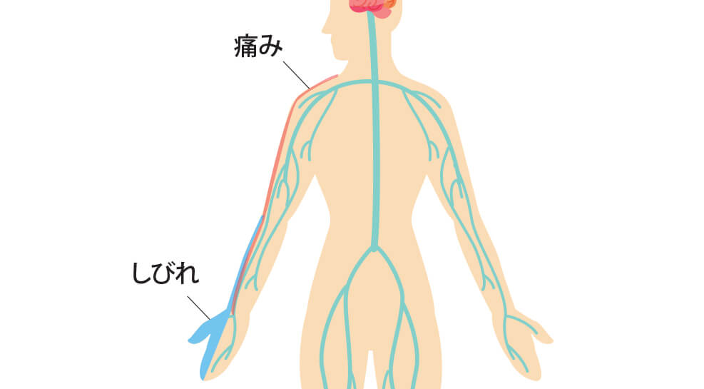 めまいの症状