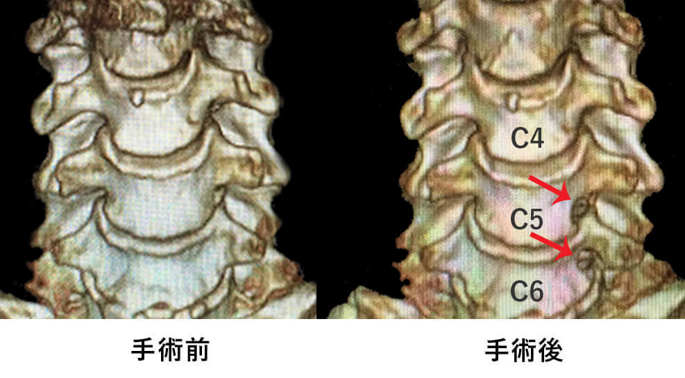 手術適応