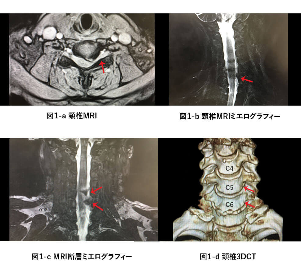 診断