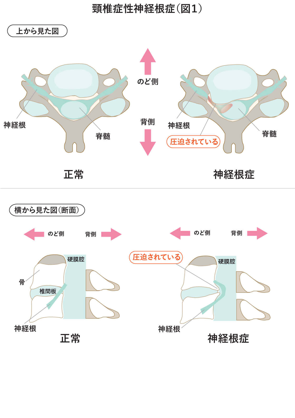 頚部の椎骨動脈