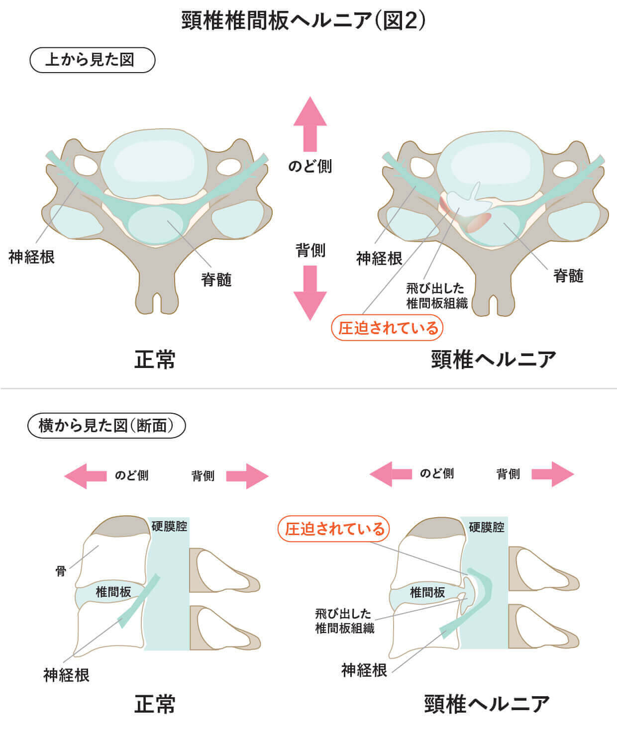 頚部の椎骨動脈