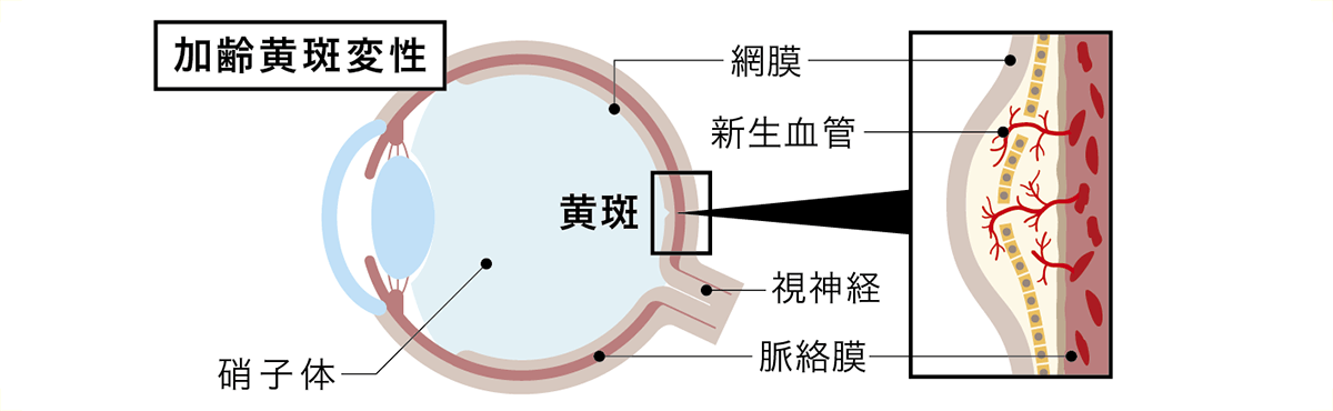 黄斑図解
