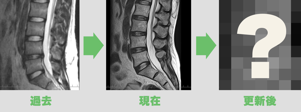 MRIの更新2