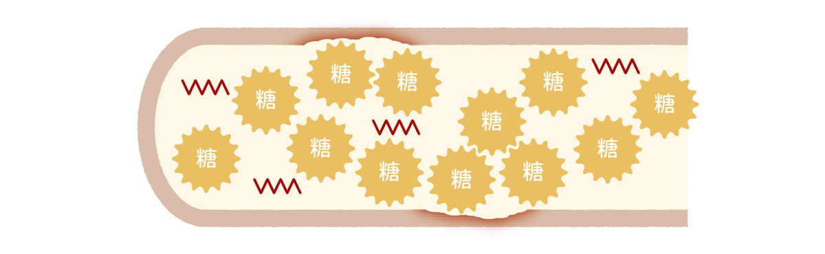 糖尿病
