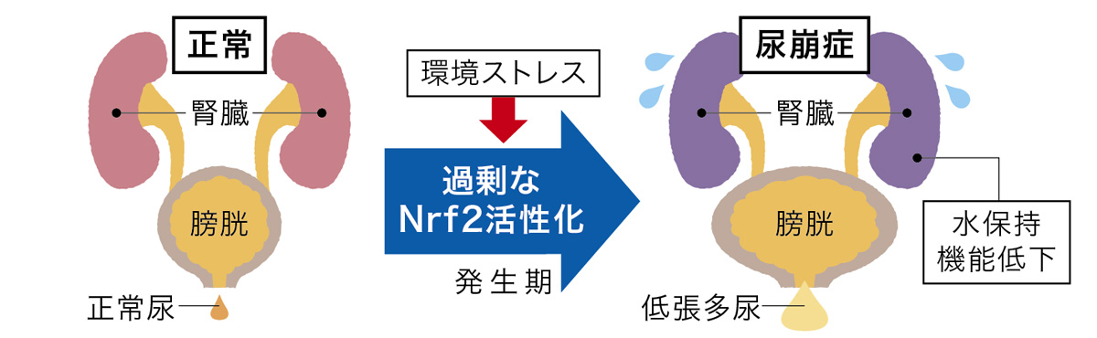 尿崩症