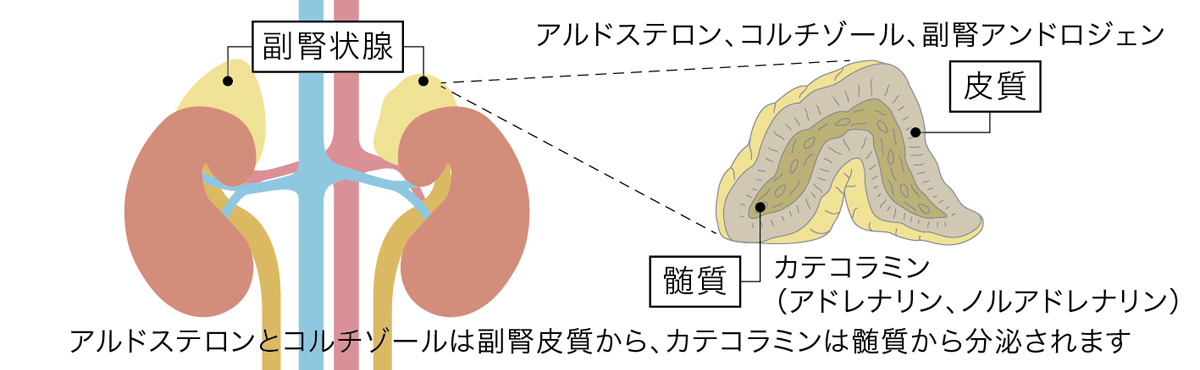 褐色細胞腫