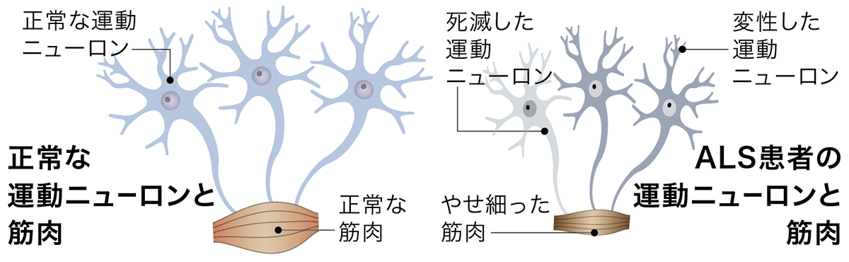 ALSイメージ