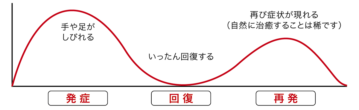 慢性炎症性脱髄性多発性神経炎イメージ