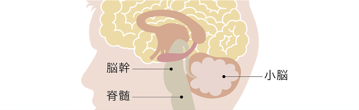 脊髄小脳変性症イメージ