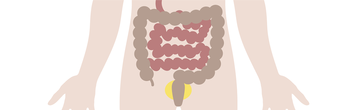 大腸ポリープイメージ