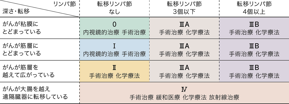大腸ガン-ステージ表