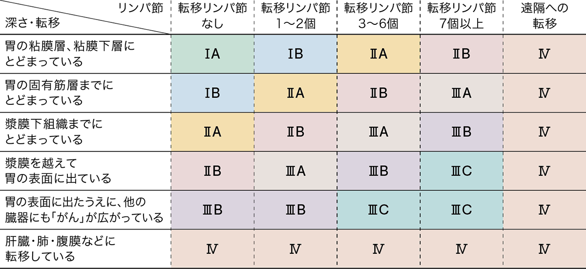 胃ガン-ステージ表