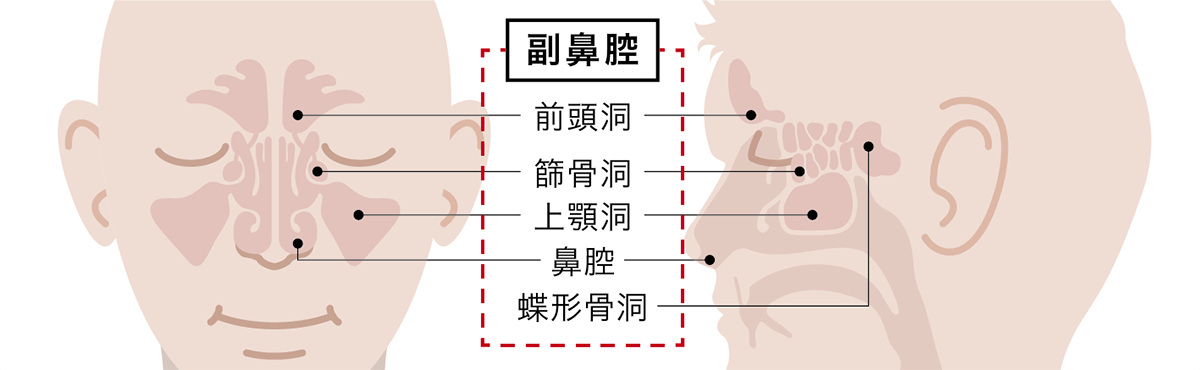 副鼻腔炎イメージ